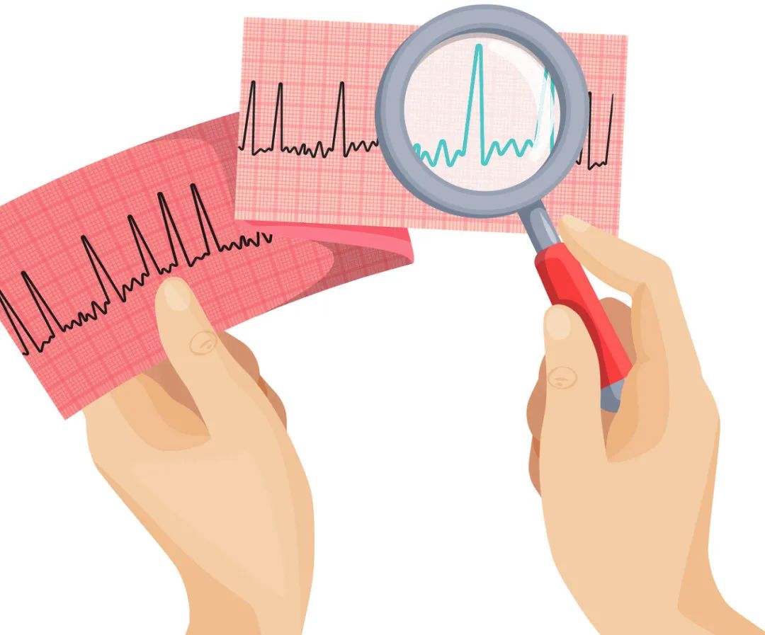 別小瞧房顫，它會(huì)導(dǎo)致兩個(gè)嚴(yán)重后果！｜中國(guó)房顫日