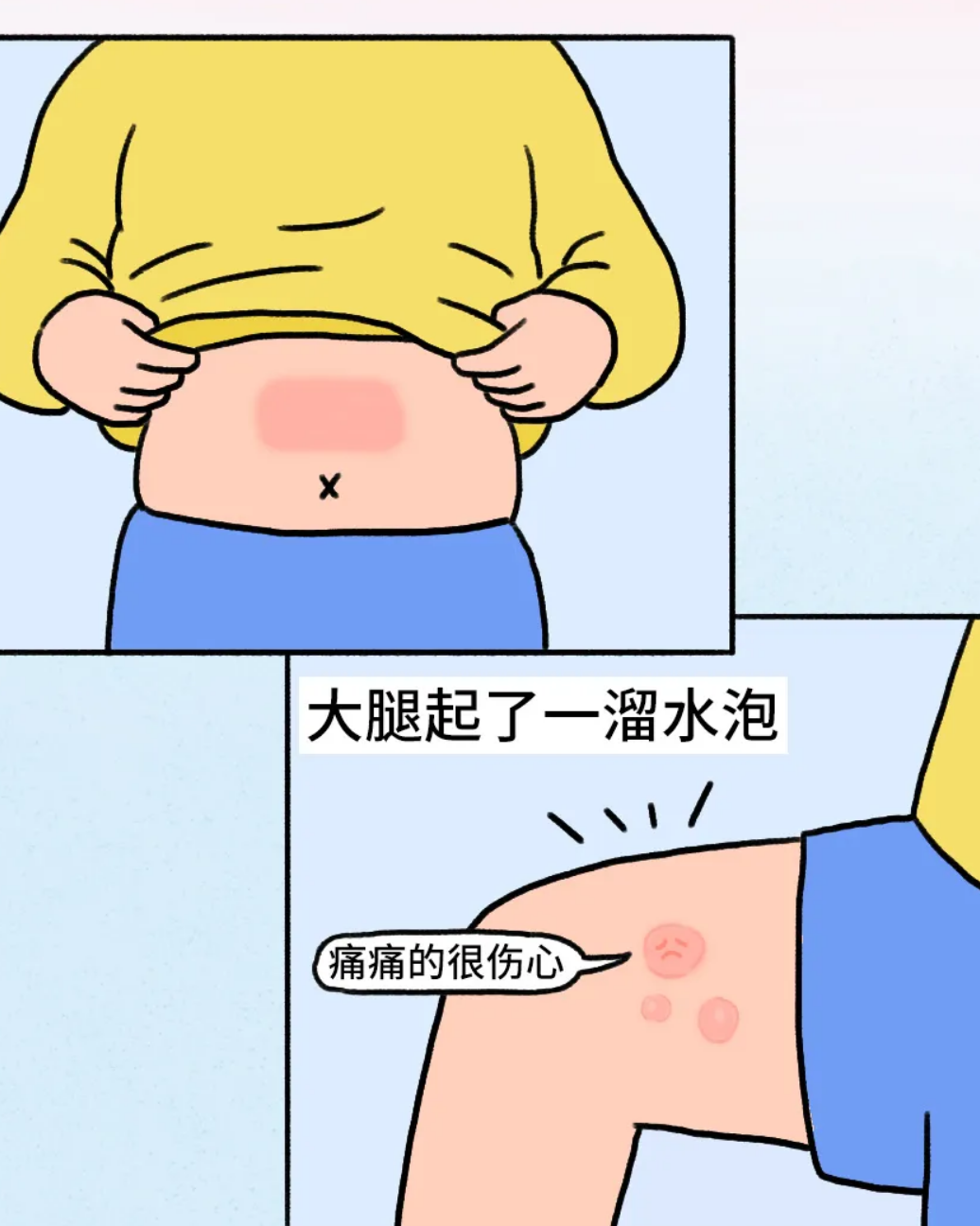 “我也沒(méi)感覺(jué)燙，咋就燙傷了？”