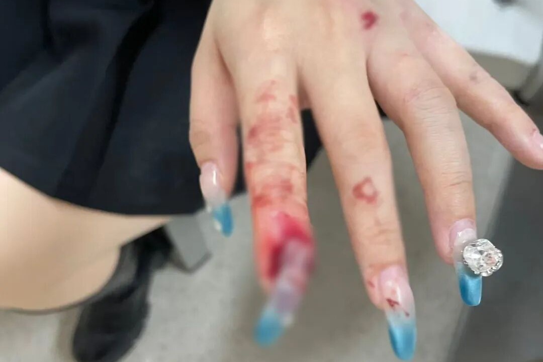 指甲當(dāng)場(chǎng)斷裂！你的新年“戰(zhàn)甲”，真的殺傷力滿(mǎn)滿(mǎn)！